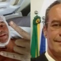 Apresentador Ulisses Barbosa passa bem depois de cirurgia e já aguarda alta