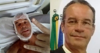 Apresentador Ulisses Barbosa passa bem depois de cirurgia e já aguarda alta