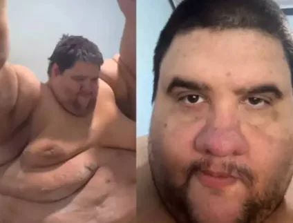 Morre influenciador que chegou a pesar 380 kg e comoveu a web com luta para emagrecer; veja